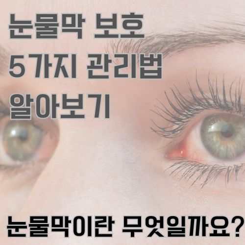 안구 건조로 충혈된 눈을 보여주는 사진 