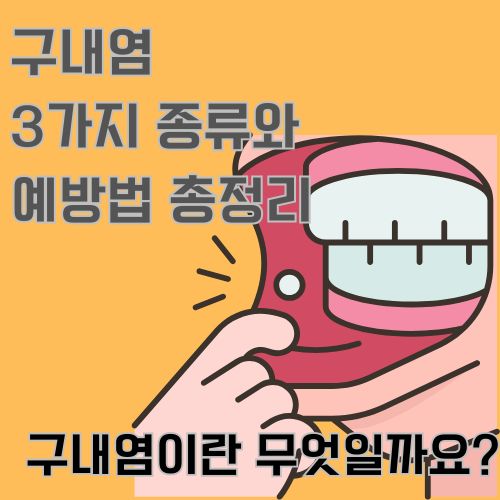 구내염이란 무엇일까요?