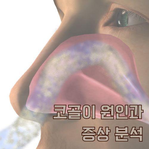 코골이의 주요 원인이 되는 구강 내 연조직과 기도 협착 상태 의료 일러스트