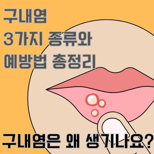 구내염의 원인에 대해서 알아봅니다. 