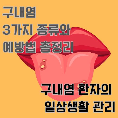 구내염을 나타낸 그림으로 입술 혓바닥에 염증을 그린 그림 