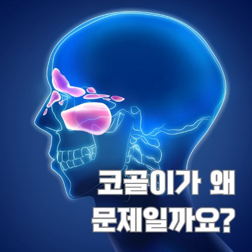 코골이의 해부학적 원인을 보여주는 두개골 단면도와 비강 구조의 의학적 일러스트레이션