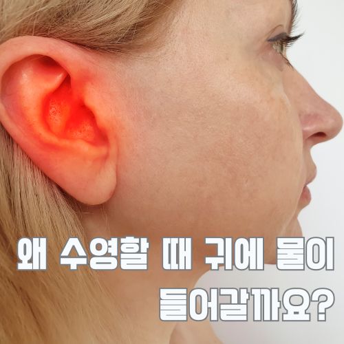 수영 후 귀 물 들어가서 통증 있는 귓바퀴 모습과 응급처치 방법 설명