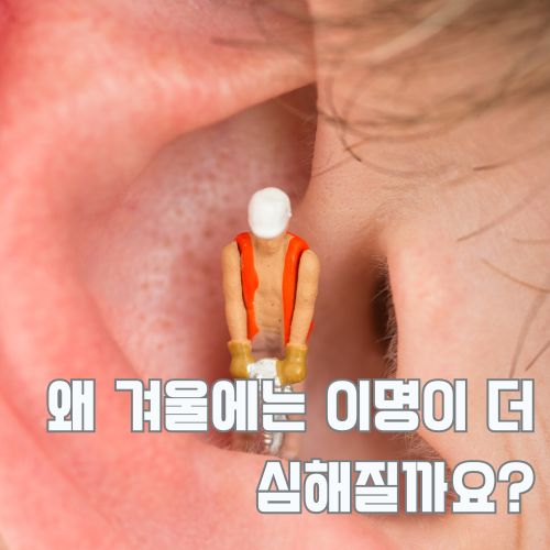 겨울철 심해지는 이명 증상 완화를 위한 귀 내부 구조와 혈액순환 개선 방법 설명