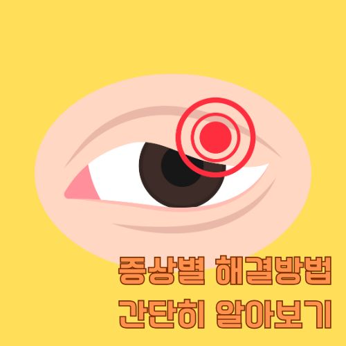 눈떨림과 안구진탕의 차이점 진단을 위한 안구진탕 증상을 나타내는 의료 일러스트레이션