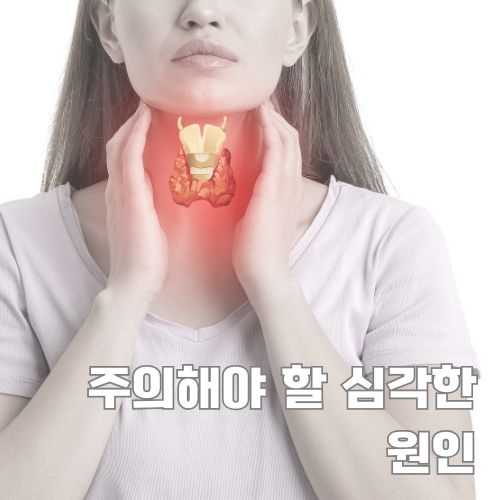 갑상선 문제로 인한 눈떨림 지속 증상을 시각화한 여성의 목 부위와 갑상선 강조 이미지